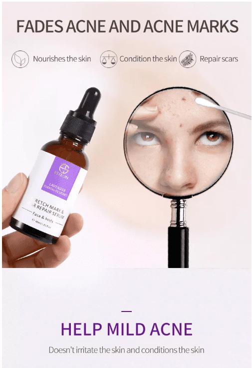 Estelin Lavender Essential Oil Extract (30ml) - Image 10