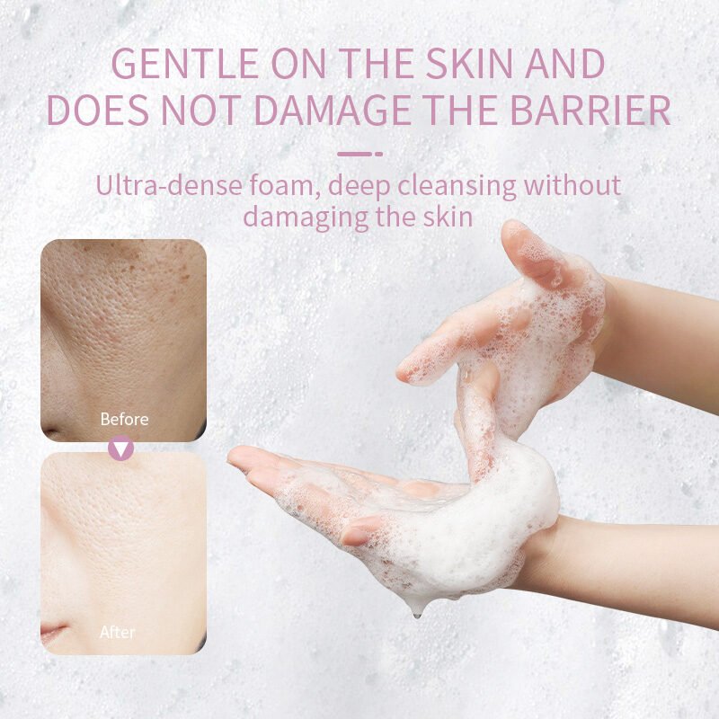 Niacinamide Fade Spots Soap (100g) - Image 4